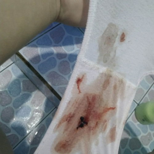 keluaran darah lendir di usia 38 week 4 days