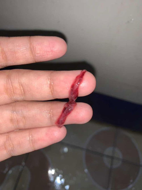 Keluar gumpalan darah