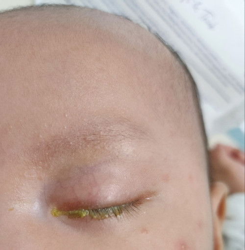 Biasa ke baby ada tahi mata macamni