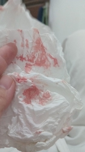 Hamil muda ..wajarkah keluar darah sprti haid