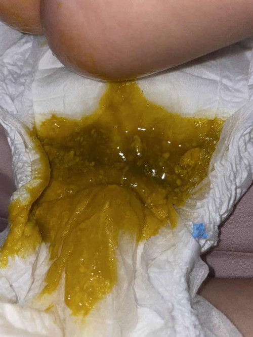 BAB lebih encer dari biasanya