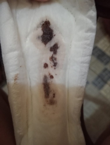 Flek usia kandungan 10 minggu
