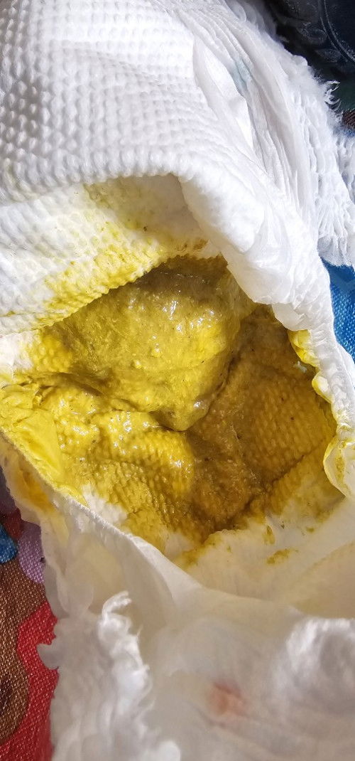 สอบถามแม่ๆว่าอึแบบนี้ผิดปกติไหมคะ