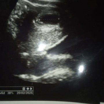 Hamil6 minggu kelihatan kntungnya