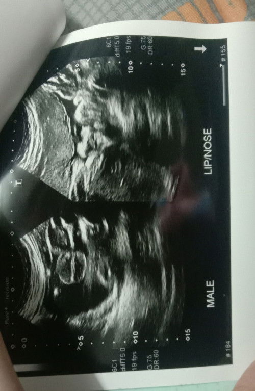 เเม่ๆพอจะทราบมั้ยคะรูปเเรกนี่ดูเป๋นเพศอะไร