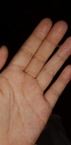 แม่ๆมีมูกออกกี่วันถึงจะคลอดคะ