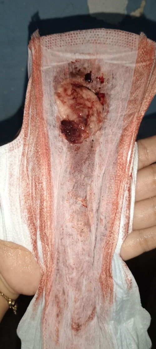 Apakah ini ke guguran bub