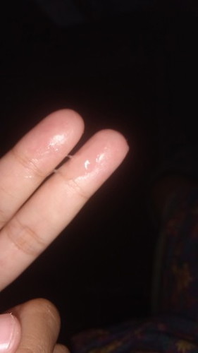 ตกขาวใช่ไหมค่ะพอดีท้องสองมีระแวงงเลยถามใหฃ้แน่ใจ