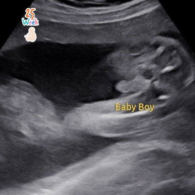 Baby boy? 👦🏻