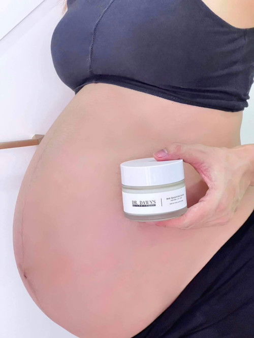 ครีมทาท้อง ป้องกันท้องแตกลายระหว่างตั้งครรภ์