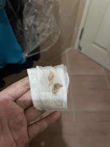 รบกวนสิบถามแม่ๆคะ