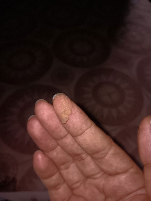 มีมูกใสๆออกนิดนึง