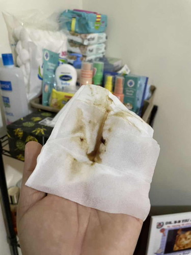 Question po mga Mhie sorry po sa picture (pasintabi po)