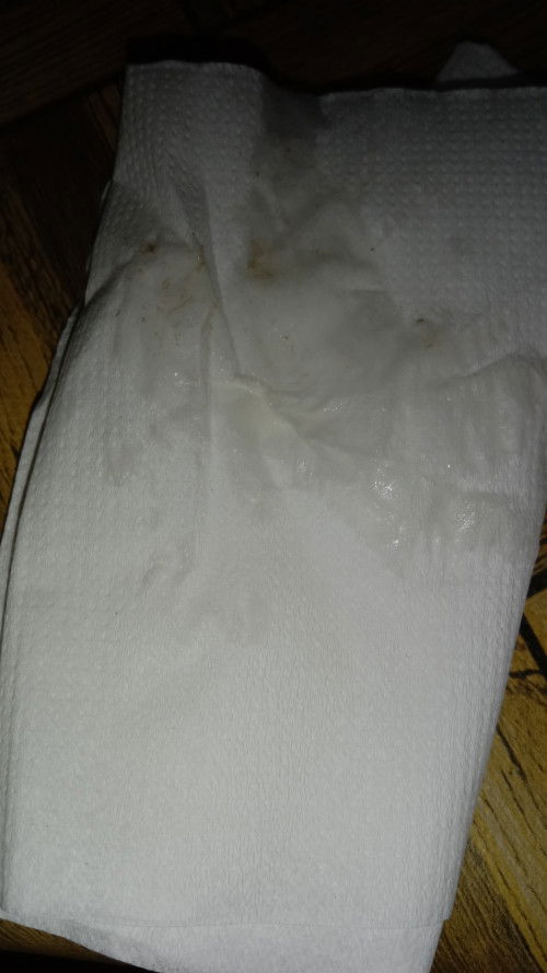 Maaf bunda mau tanya saya barusan keluar kya gini, tpi rasanya kya letupan gitu pas keluar