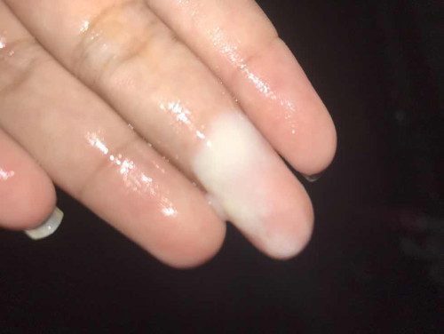 ((รูปตกขาว)) แบบนี้ปกติไหมคะ