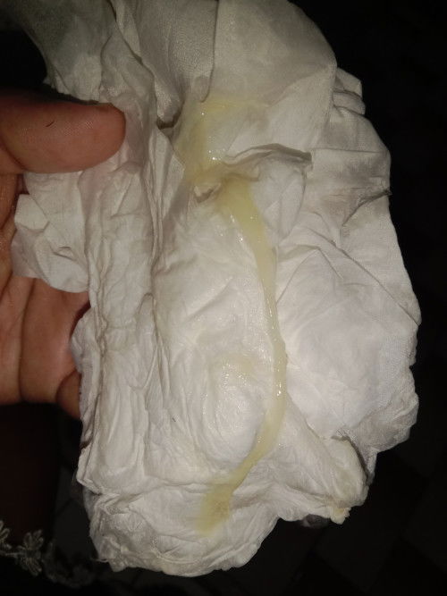 39  กำหนดคลอด29 กรกฎาคม 2567