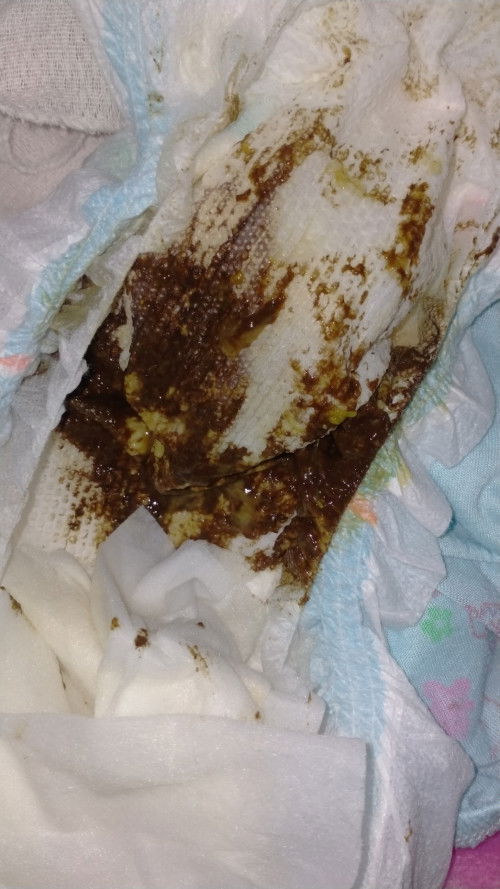 Hello momies nag wowory napo ako sa dumi ng anak ko parang black normal kaya yun.