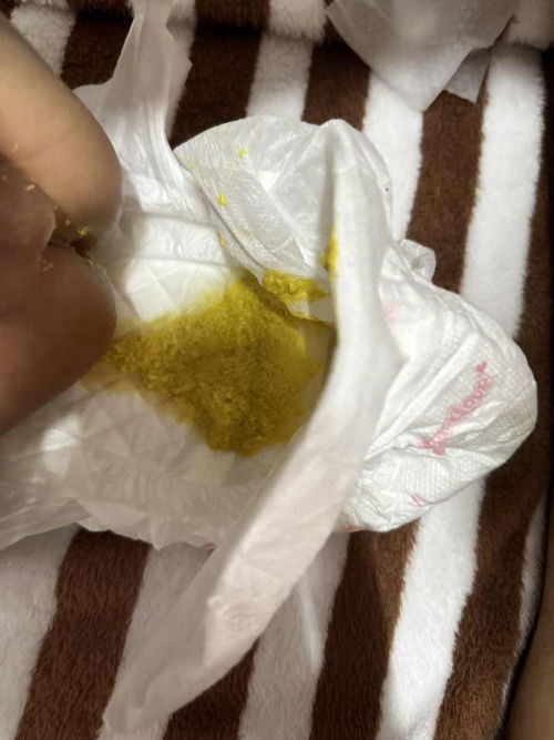 น้อง อายุ 2 เดือน 7 วันคะ