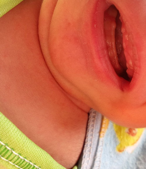 Putih² digusi sama langit² mulut bayi