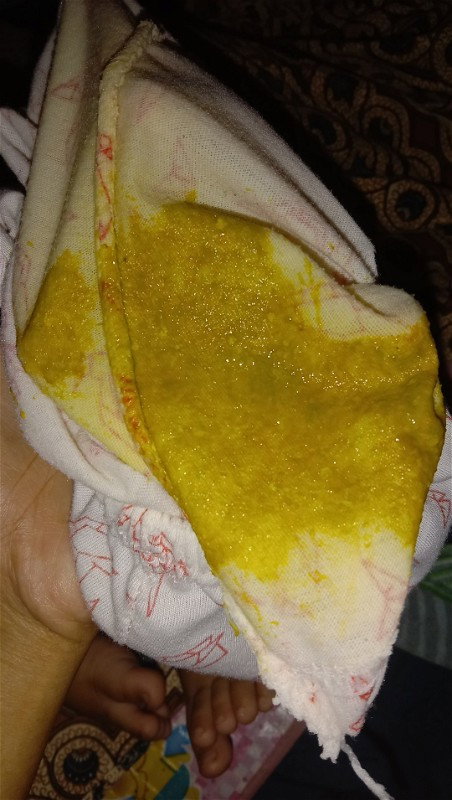 Bayi pup 3-4 kali sehari