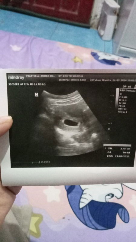 Hpht sama USG beda itungan