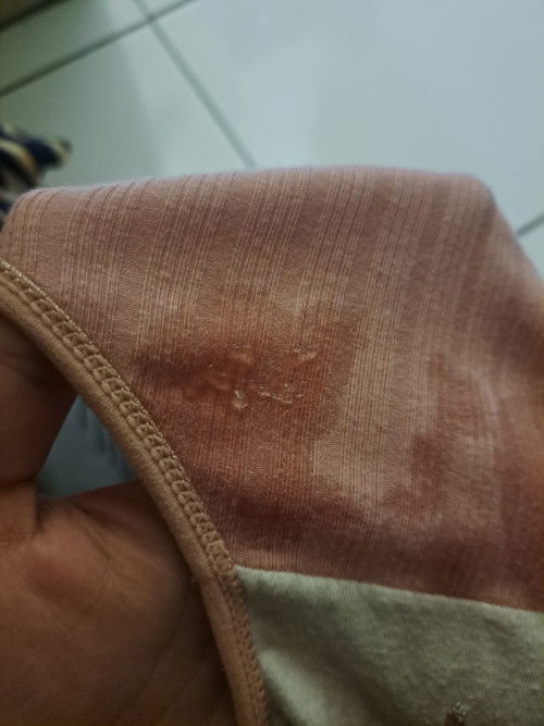 Keluar cairan bening