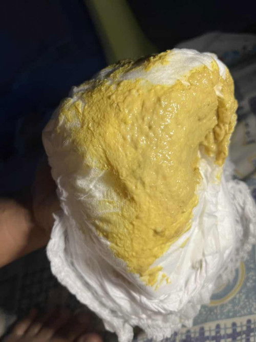 น้องอึเหมือนมีหมูก