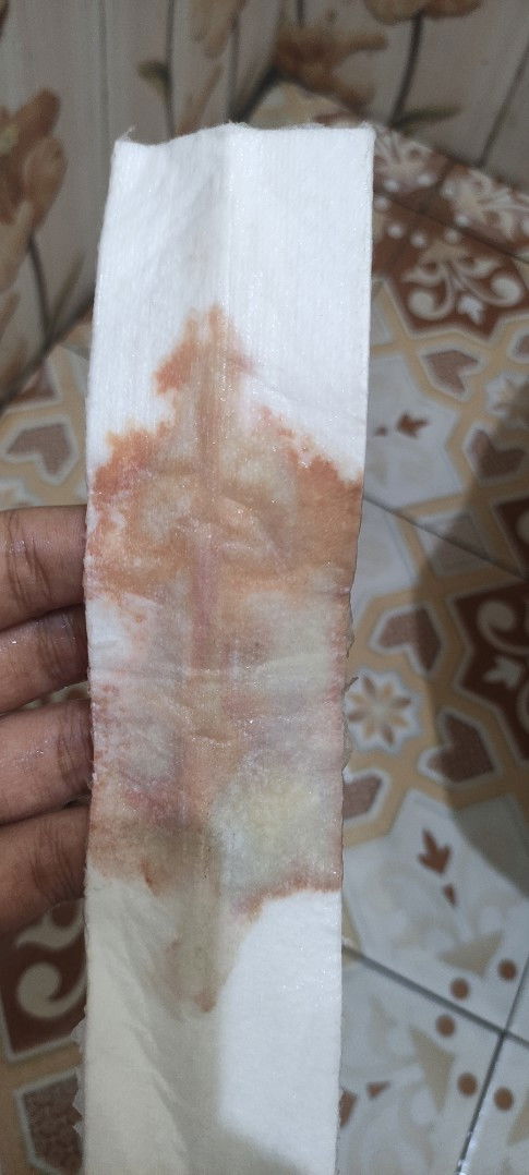 Keluhan rembes pasca Caesar