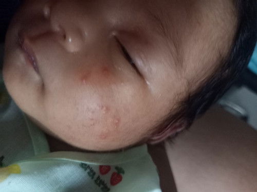 น้อง18วัน