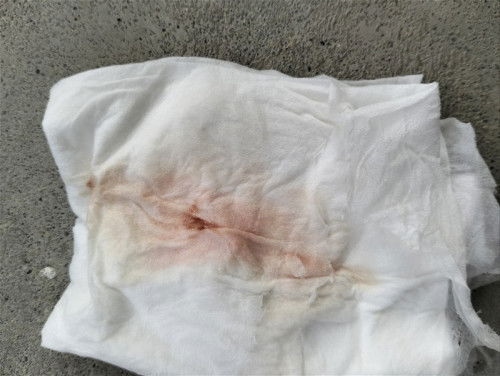 Hamil 20 week keluar darah