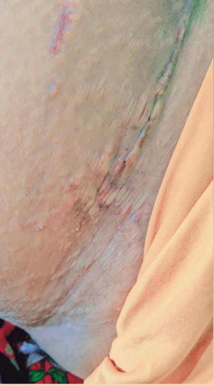 Ada bintik putih di sekitar bekas SC