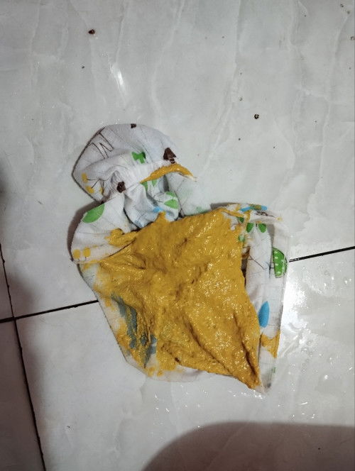 con e đổi sữa đi phân này bình thường không ạ ngày đi 1 hoặc 2 lần..k có mùi chua