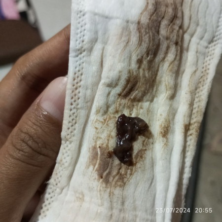 Selepas ambil sample keputihan dan check jalan