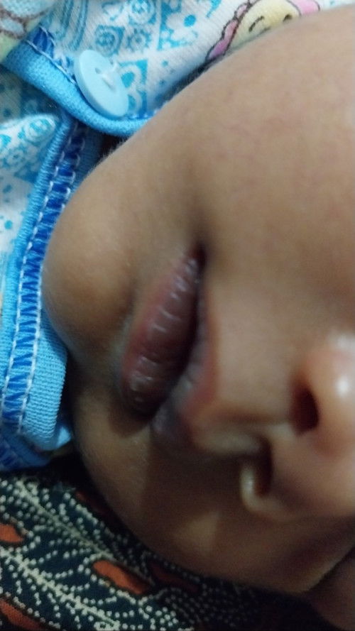 Bibir keunguan dan seperti kering pecah2