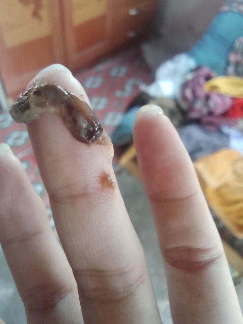 อายุครรภ์21สัปดาห์