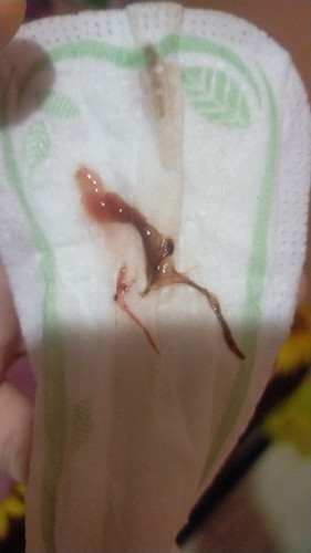 Risau ada tompokan drh slps bsama suami