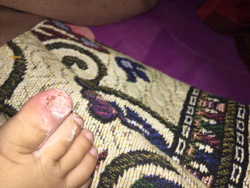 Bun ada yang anak nya pernah kek ginih jg ngk?