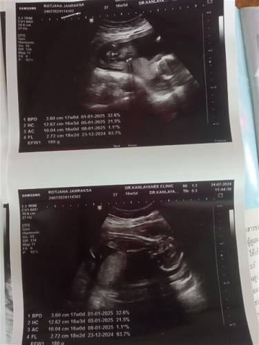 16+5วีค ซาวด์ดูเพศลูก