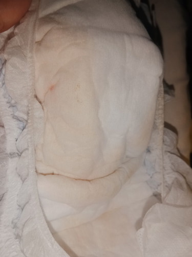 Mga mommy my newborn Ako 3days old baby boy.normal lang kaya wiwi nya may toldok na pula parang dugo