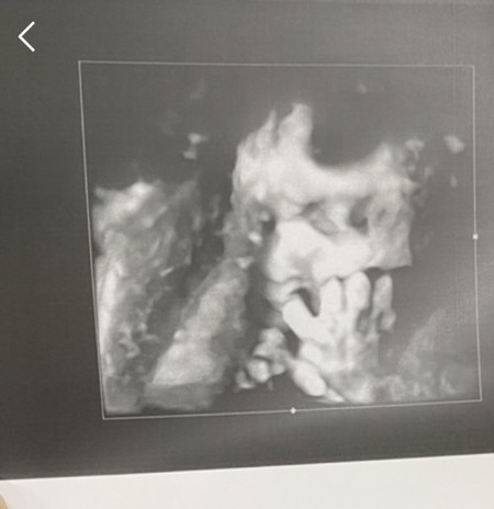 31+5 ขอดูภาพน้องๆตอนไกล้คลอดหน่อยค่ะ