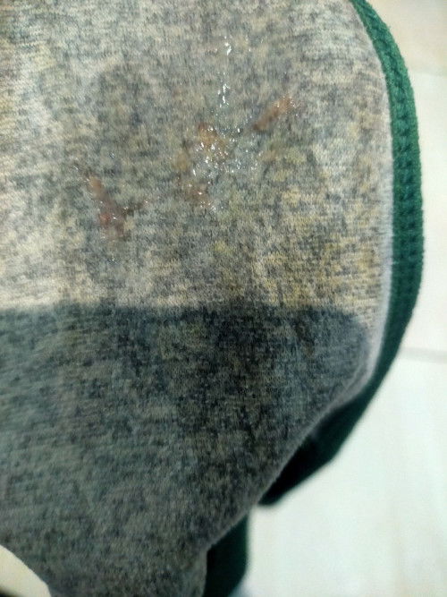 Izin bertanya saya hamil di 10 lebih  tiba tiba saya kluar keputihan tp aga berwarna KY mau heid git