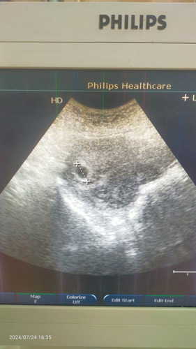 Sekadar luahan.. Scan hny nmpk kantung kosong..