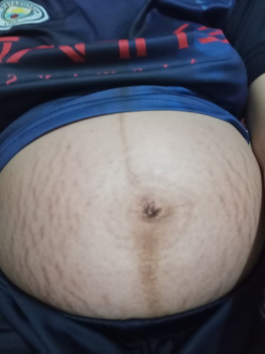Có mom nào tình trạng giống em không 🙂↔️