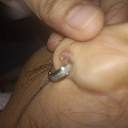 Helpppppppppll