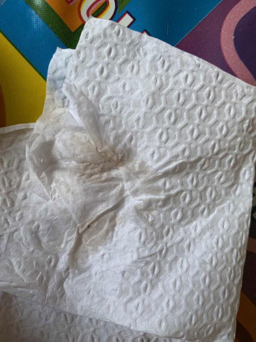 สอบถามแม่ๆหน่อยคะ ท้องได้ 22 สัปดาห์ 6 วัน พอดีเข้าห้องน้ำมา แล้วมีของเหลวออกแบบนี้ ปกติไหมคะ หรือต้องไปหาหมอ