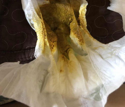 JENIS BERAK NORMAL ATAU TAK