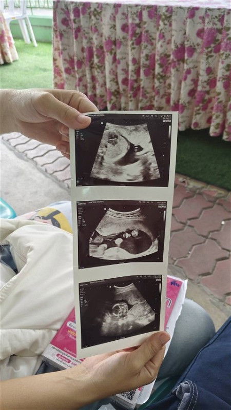 สอบถามแม่ๆค่ะ 19w