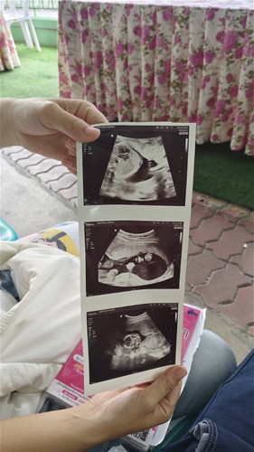 สอบถามแม่ๆค่ะ 19w