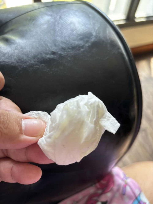 Discharge coming out from V