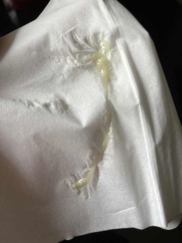 Discharge yellowish white